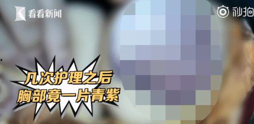 乳房爆料视频,一场关于女性健康的探讨  第3张